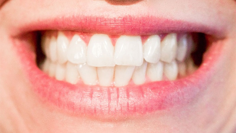 estrés y salud bucodental